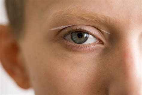 Common Eye Diseases - Brain Overflow- An Eye Doctors Blog