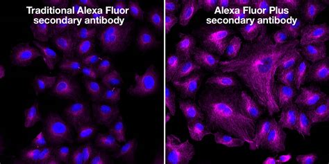 Alexa Fluor Plus Secondary Antibodies | Thermo Fisher Scientific - US