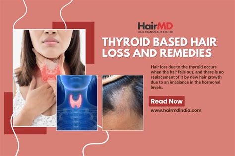 Thyroid Based hair loss and remediesc : HairMD in Pune