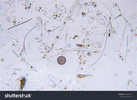 Marine Aquatic Plankton Under Microscope View Stock Photo 726037792 | Shutterstock