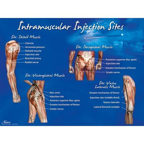 Intramuscular Injection Sites Poster - SEM Trainers