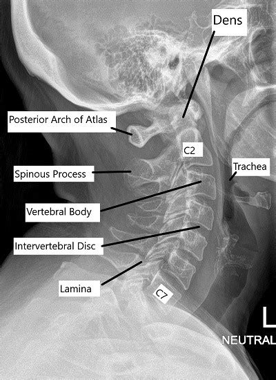 Anatomy of the Spine - Complete Orthopedics & Podiatry | Multiple NY Locations