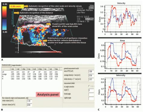 Pediatric Applications of Perfusion Ultrasound | Radiology Key