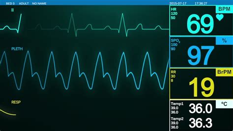 heartbeat monitor screen ecg displays heart Stock Footage Video (100% Royalty-free) 11595830 ...