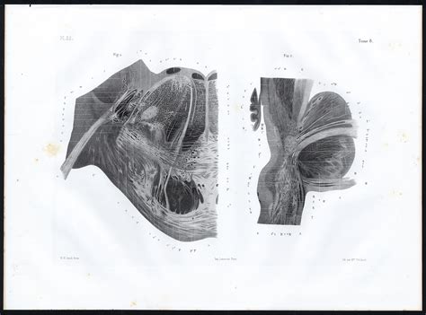 Antique Anatomy Print-MICROSCOPIC-NERVES-PONS VAROLII-Pl. 35-Bourgery ...