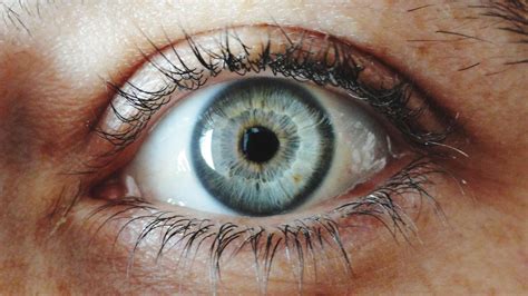 What Is the Rarest Eye Color?