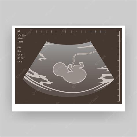 Baby Ultrasound Stock Illustrations – 4,822 Baby Ultrasound Stock - Clip Art Library