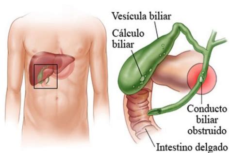 Anatomía vesícula biliar