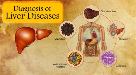 Diagnosis of liver diseases - ParsiTeb :: Herbal Medicine