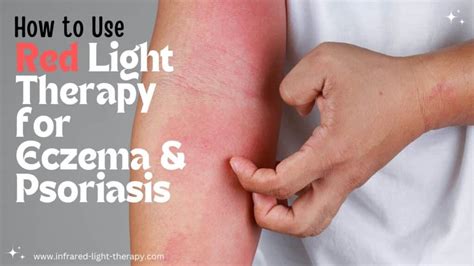 How to Use Red Light Therapy for Eczema and Psoriasis