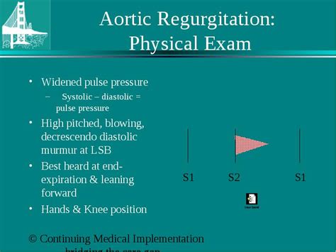 Valvular Heart Disease Aortic Regurgitation