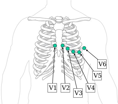 Precordial Leads Ekg