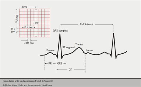 Ecg Interpretation