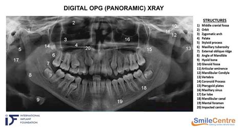 Dental Imaging Faciliy | What is OPG X-ray? | Smile Centre India