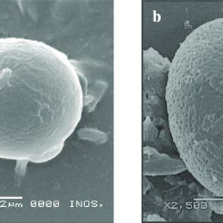 Morphology of ciliates observed. (a) Ciliates in cysts state and (b)... | Download Scientific ...