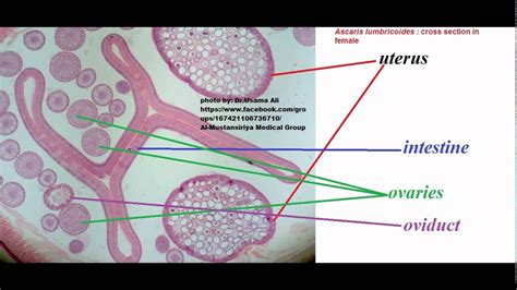 Ascaris Lumbricoides Male And Female Cross Section | Porn Sex Picture