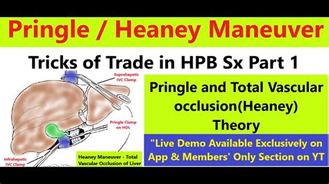 How to do Pringle Maneuver - Complete Guide (Tricks of Trade in HPB Sx Part 1/8). #pringle - YouTube