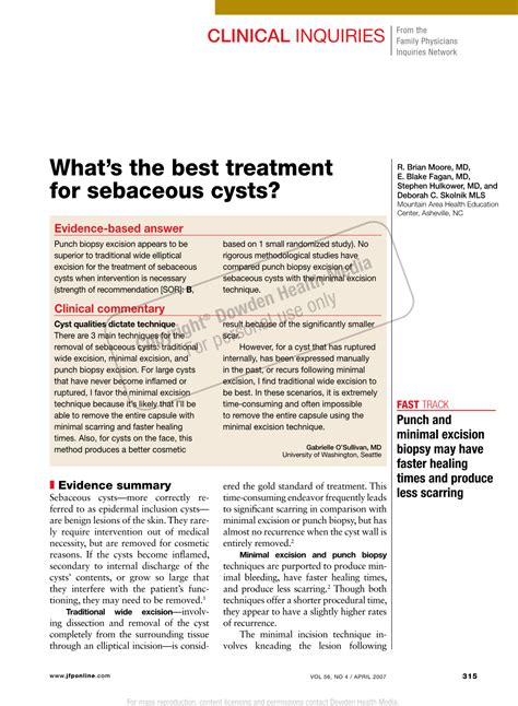 What's the Best Treatment for Sebaceous Cysts? - DocsLib