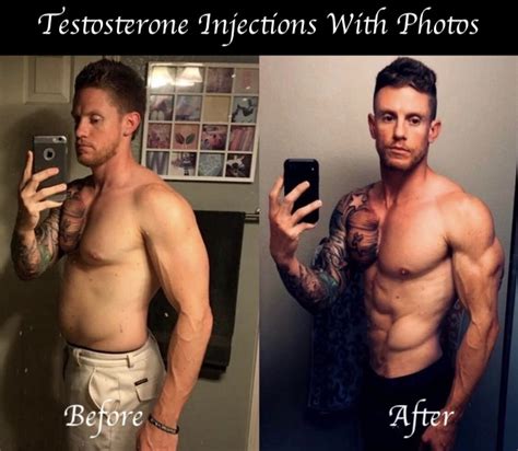 Testosterone Injections Before And After Photos | HGH