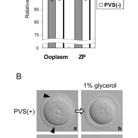 Formation of the perivitelline space (PVS) in mouse oocytes during in... | Download Scientific ...