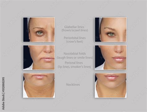 Ageing skin ,internal and external causes of skin aging, signs of skin aging Stock Photo | Adobe ...