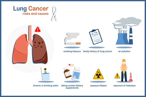 Causes and risk factors that cause lung cancer,medical vector ...