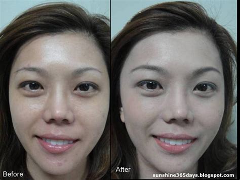 simpale: More Dermaline skin whitening bb cream before and after