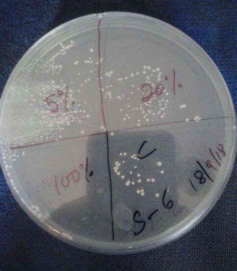 Nutrient agar plate showing total microbial count in Periodontitis ...