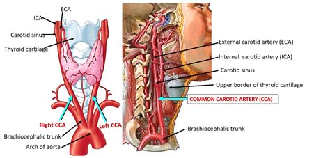 Common Carotid Artery - Anatomy QA