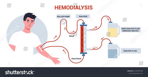 3,325 Patient On Dialysis Images, Stock Photos & Vectors | Shutterstock