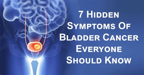 7 Hidden Symptoms Of Bladder Cancer Everyone Should Know - David Avocado Wolfe