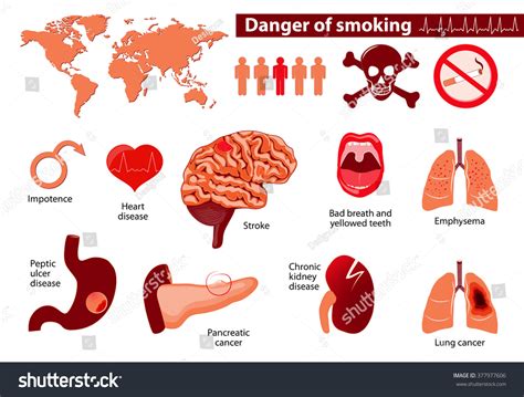 Danger Smoking Signs Symptoms Stage Risk Stock Vector (Royalty Free) 377977606 | Shutterstock