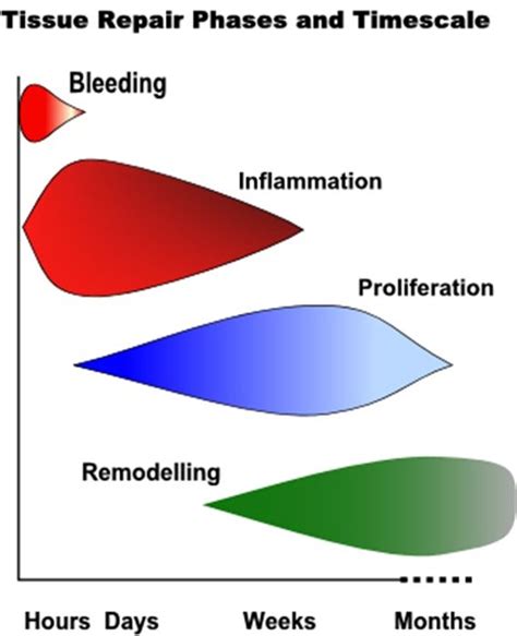 Soft Tissue Repair and Healing Review | Injury rehabilitation, Healing, Repair