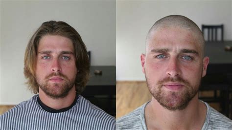 Balding Buzz Cut Before And After