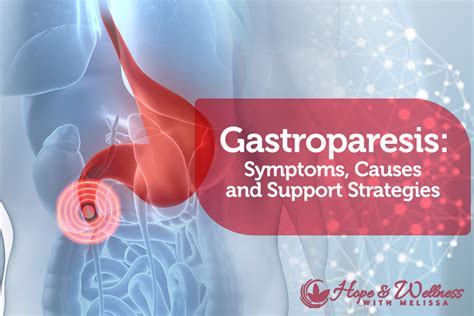 Gastroparesis: Symptoms, Causes and Natural Support Strategies - Hope ...