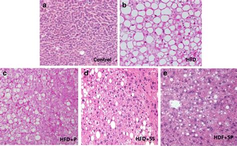 Histopathological examination of liver tissue showing damage and... | Download Scientific Diagram