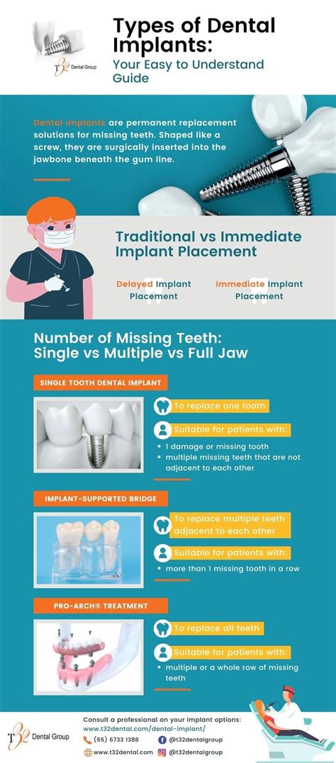 Types of Dental Implants – Your Easy-to-Understand Guide