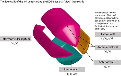 The ECG leads: electrodes, limb leads, chest (precordial) leads, 12 ...