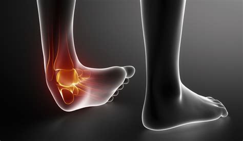 Factors Involved in Recovery Times For Soft Tissue Injuries