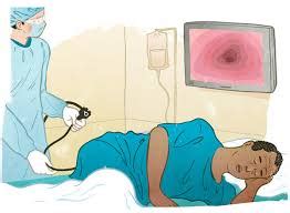 DO YOU NEED AN ANESTHESIOLOGIST FOR A COLONOSCOPY? - The anesthesia consultant