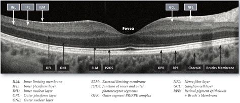 Retinal Layers Oct