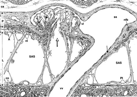 Schematic representation of an arachnoid granulation located within a... | Download Scientific ...