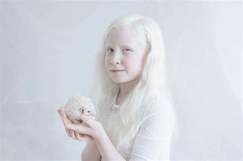 Photographer Yulia Taits Captures Captivating World Of Albino Beauty