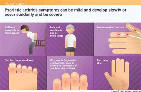 Psoriatic Arthritis - Symptoms, Causes, Treatment & More