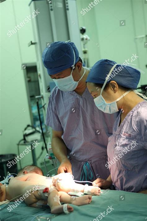 Conjoined Twins During Surgery Separate Them Editorial Stock Photo - Stock Image | Shutterstock