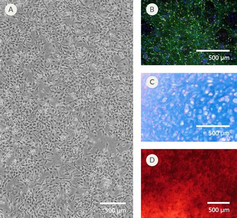 STEMdiff™ Neural Crest Differentiation Kit | STEMCELL Technologies