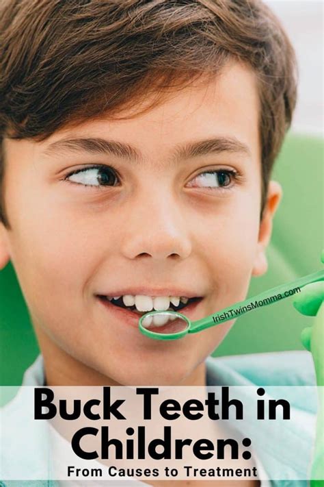 Buck Teeth in Children: From Causes to Treatment - The Irish Twins Momma