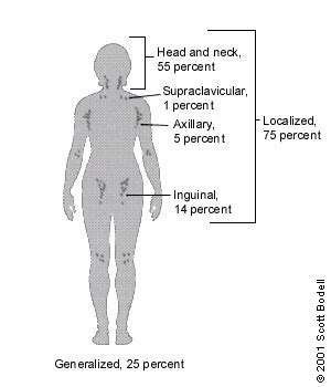 Lymphadenopathy: Differential Diagnosis and Evaluation | AAFP