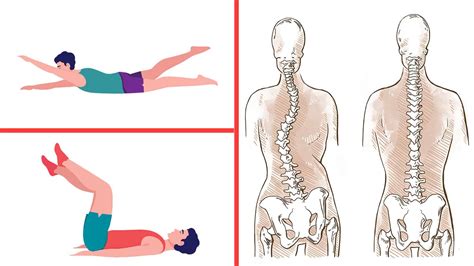 4 Exercises For People With Scoliosis - Divine Magazine