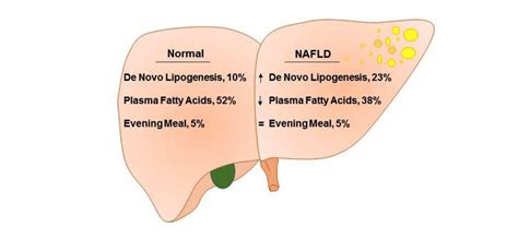 CrossFit | Role of Dietary Fructose and Hepatic De Novo Lipogenesis In ...